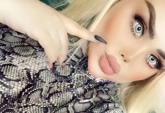 She Endured 43 Surgeries To Become A Real-Life Barbie.  The Internet Calls Her A Zombie.