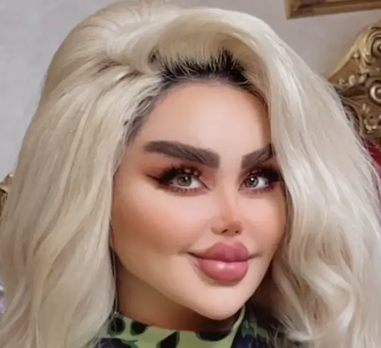 She Endured 43 Surgeries To Become A Real-Life Barbie.  The Internet Calls Her A Zombie.