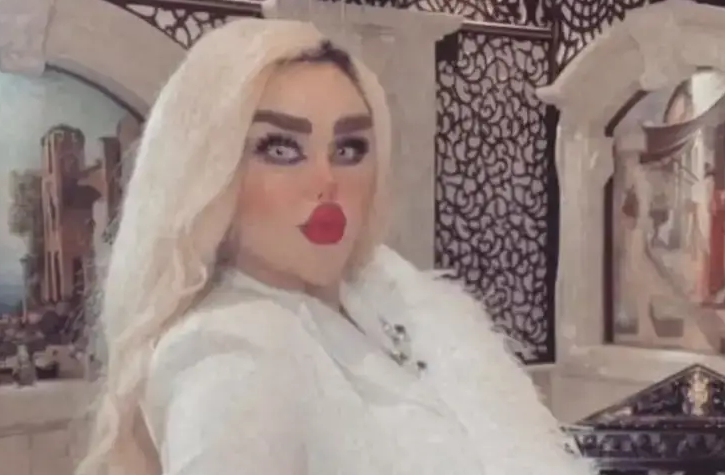 She Endured 43 Surgeries To Become A Real-Life Barbie.  The Internet Calls Her A Zombie.