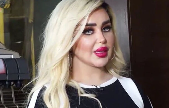 She Endured 43 Surgeries To Become A Real-Life Barbie.  The Internet Calls Her A Zombie.