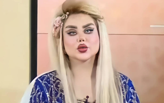 She Endured 43 Surgeries To Become A Real-Life Barbie.  The Internet Calls Her A Zombie.