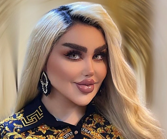 She Endured 43 Surgeries To Become A Real-Life Barbie.  The Internet Calls Her A Zombie.