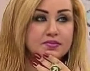 She Endured 43 Surgeries To Become A Real-Life Barbie.  The Internet Calls Her A Zombie.