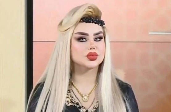 She Endured 43 Surgeries To Become A Real-Life Barbie.  The Internet Calls Her A Zombie.